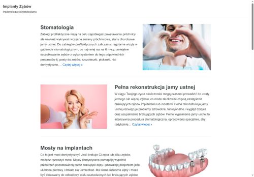 implantyzebow.com
