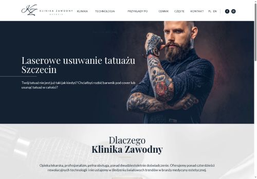 usuwanietatuazu.szczecin.pl